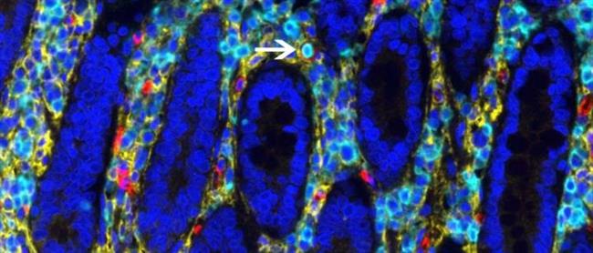 ep celulas madre hematopoyeticasintestino