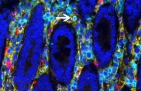 ep celulas madre hematopoyeticasintestino