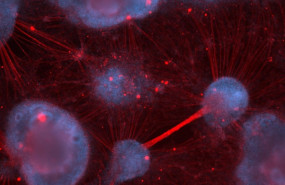 ep la imagen muestra neuronas sensoriales humanas derivadascelulas madre cultivadaslaboratorio