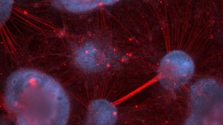 La imagen muestra neuronas sensoriales humanas derivadas de células madre cultivadas en el laboratorio. | ALEXANDRA SARGINSON ep la imagen muestra neuronas sensoriales humanas derivadascelulas madre cultivadaslaboratorio