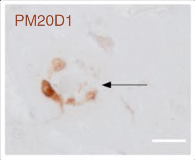 ep gen pm20d1