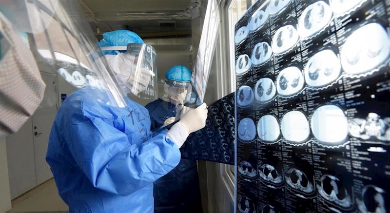 ep medicos militares observan pruebas medicas realizadas a pacientes enfermos de coronavirus en ep medicos militares observan pruebas medicas realizadas a pacientes enfermos de coronavirus en