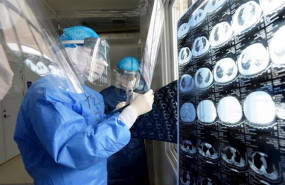 ep medicos militares observan pruebas medicas realizadas a pacientes enfermos de coronavirus en