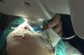 ep operacion de cataratas
