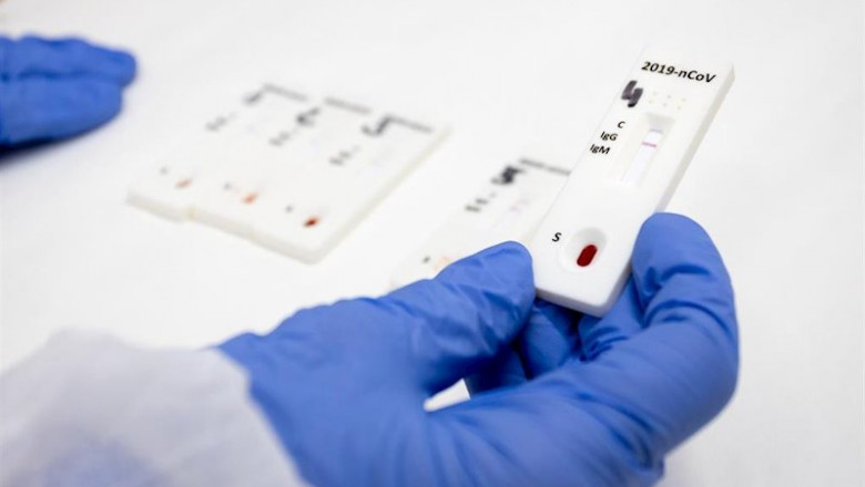ep unas manos con guantes azules sujetan un test