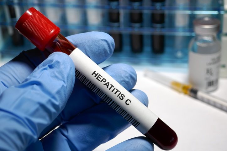 ep hepatitis c treatment hepatitis c - sexually transmitted disease blood test and treatment ep hepatitis c treatment hepatitis c - sexually transmitted disease blood test and treatment