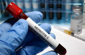 ep hepatitis c treatment hepatitis c - sexually transmitted disease blood test and treatment