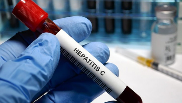 ep hepatitis c treatment hepatitis c - sexually transmitted disease blood test and treatment