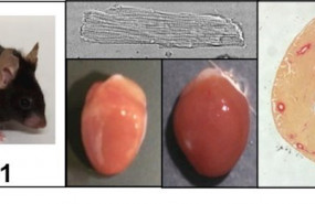 ep los animales transgenicos para nor-1 tgnor-1 tienen celulas cardiacas cardiomiocitos de mayor