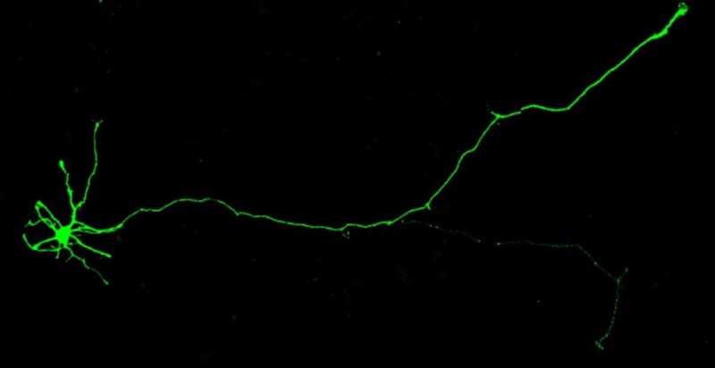 ep imagen de neuronas humanas inducidas que se utilizaron en el estudio para modelar los efectos