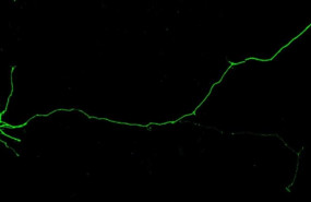 ep imagen de neuronas humanas inducidas que se utilizaron en el estudio para modelar los efectos