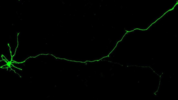 ep imagen de neuronas humanas inducidas que se utilizaron en el estudio para modelar los efectos
