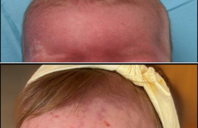 1596703690 antes despu s