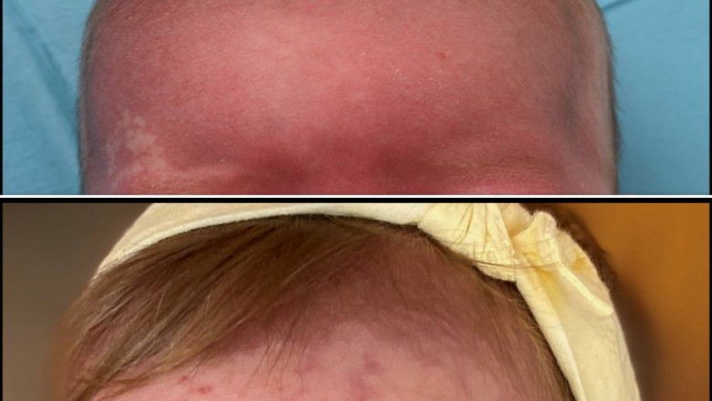 1596703690 antes despu s