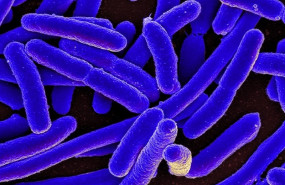 ep e coli bacteria 20190819115304
