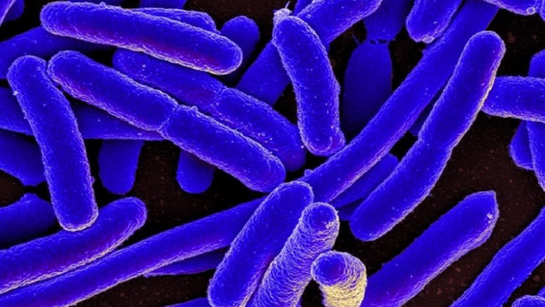 E. Coli Bacteria | NIAID/ FLICKR - Archivo ep e coli bacteria 20190819115304