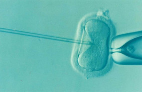 ep fecundacion in vitro 20200601113104