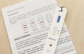 ep kits utilizados para la realizacion de los test rapidos