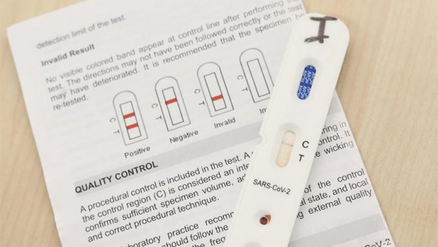 ep kits utilizados para la realizacion de los test rapidos