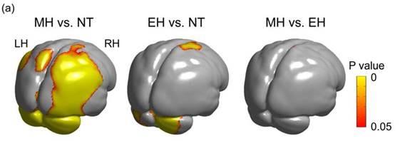 Morfología de los cerebros de neandertales, humanos modernos y primeros sapiens | T. KOCHIYAMA ET AL. ep morfologialos cerebrosneandertales humanos modernosprimeros sapiens