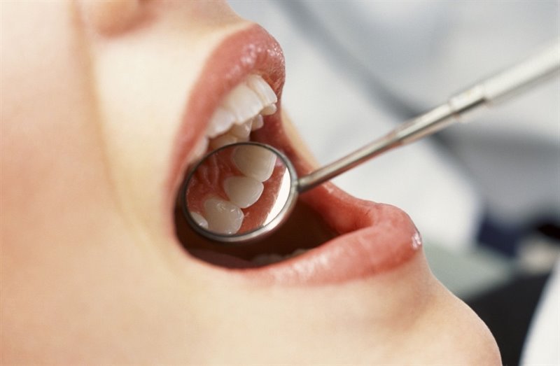 ep dientes dentista boca bucodental