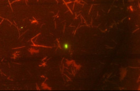 ep imagenmicroscopiabacterias vivas verde enmuestrabilis humana