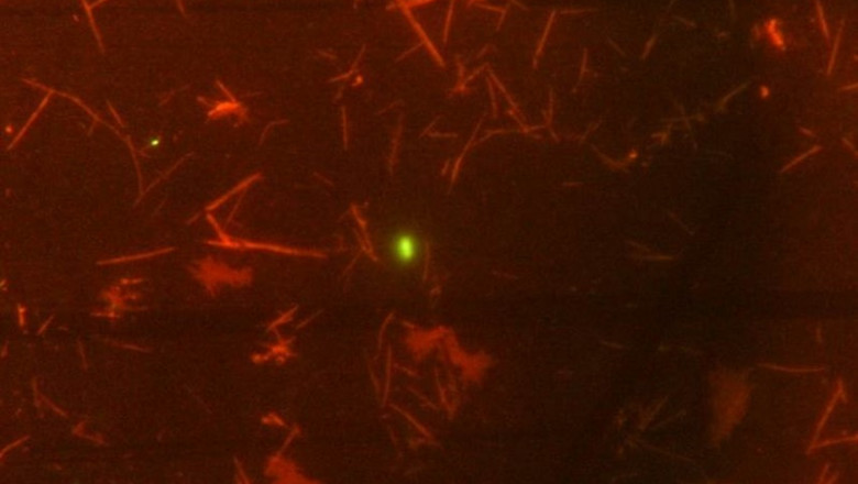 Imagen de microscopía de bacterias vivas (verde) en una muestra de bilis humana | CSIC-IPLA ep imagenmicroscopiabacterias vivas verde enmuestrabilis humana