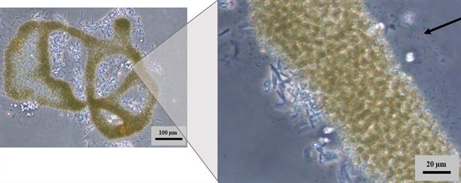 Colonia formada por células de la cianobacteria Microcystis aeruginosa | MARÍA ÁNGELES LEZCANO VEGA ep colonia formadacelulasla cianobacteria microcystis aeruginosa