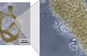 ep colonia formadacelulasla cianobacteria microcystis aeruginosa