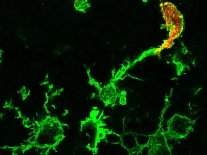 ep macrofagos que emigran desde la medula osea rojo y la microglia residente en el cerebro verde