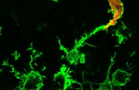 ep macrofagos que emigran desde la medula osea rojo y la microglia residente en el cerebro verde