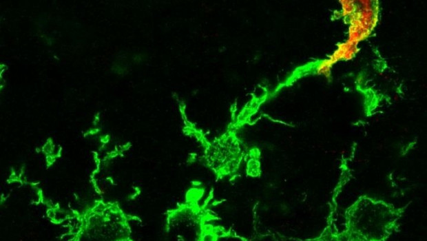 ep macrofagos que emigran desde la medula osea rojo y la microglia residente en el cerebro verde