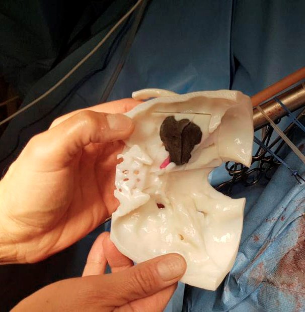 ep biomodelo impreso den 3d