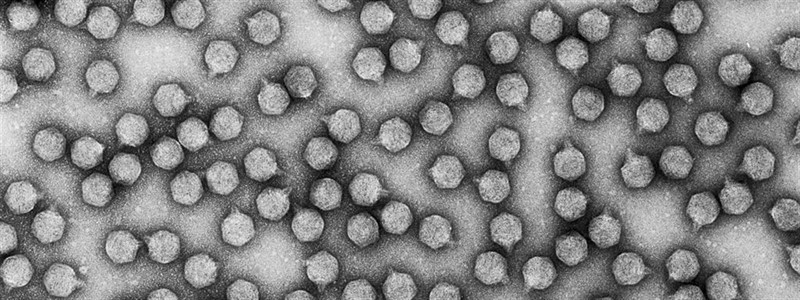 Imagen del virus bacteriófago T7 | CSIC ep imagenvirus bacteriofago t7