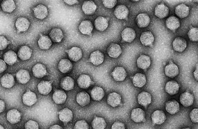 ep imagenvirus bacteriofago t7