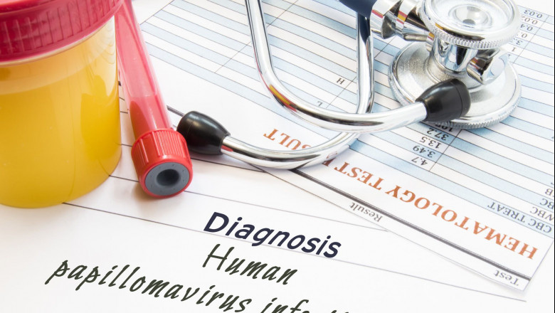 1598980335 istock 877183828 prensa