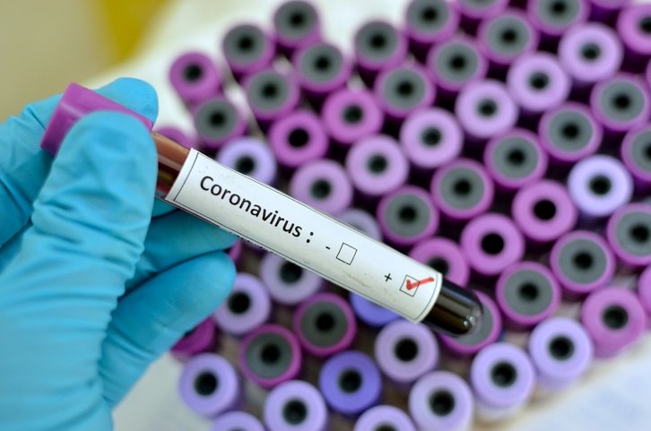 ep coronavirus positive blood sample with respiratory coronavirus positive ep coronavirus positive blood sample with respiratory coronavirus positive