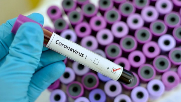 Coronavirus | JARUN011 / JARUN011 - Archivo ep coronavirus positive blood sample with respiratory coronavirus positive