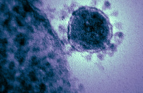 ep imagen de archivo de un coronavirus ep imagen de archivo de un coronavirus