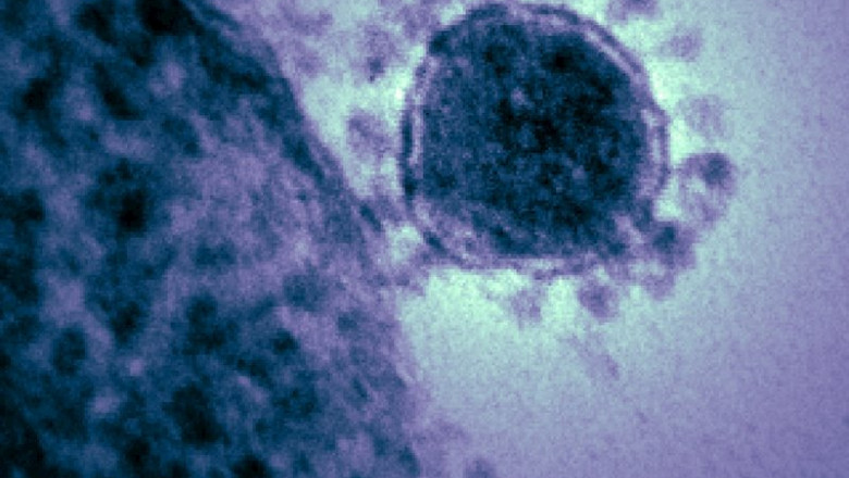 Imagen de archivo de un coronavirus | INSTITUTO NACIONAL DE SALUD DE EEUU - Archivo ep imagen de archivo de un coronavirus