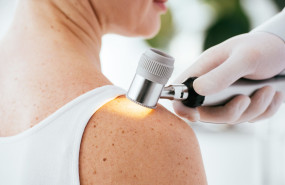 dermatoscopio 2 dermatoscopio 2