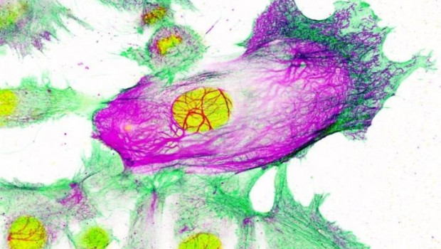 ep celulas de cancer de mama resistentes a los medicamentos rodeadas de celulas no resistentes el