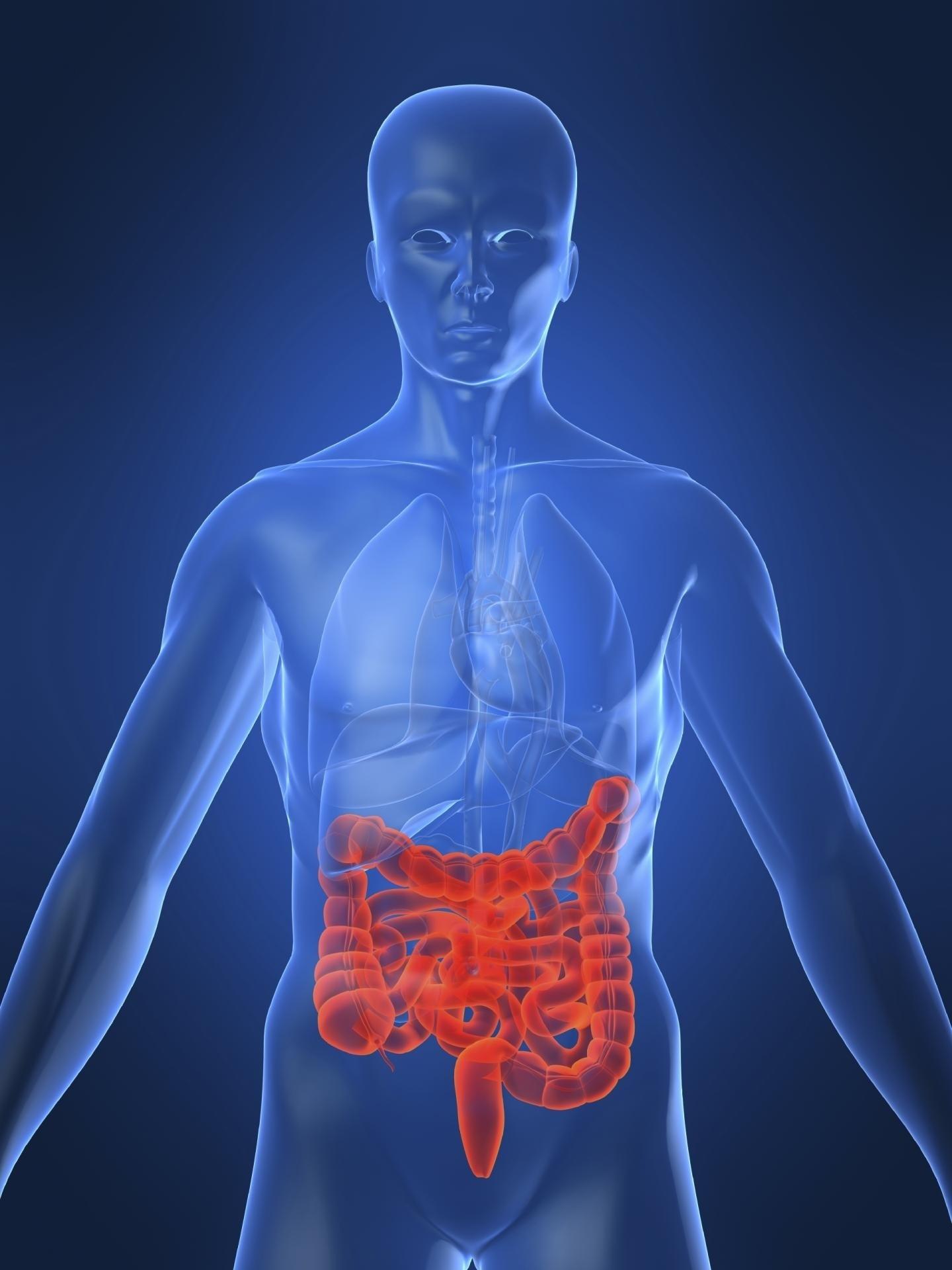Enfermedad de Crohn, intestino, enfermedad intestinal | BIODESIGN INSTITUTE, ARIZONA STATE UNIVERSITY ep enfermedadcrohn intestino enfermedad intestinal