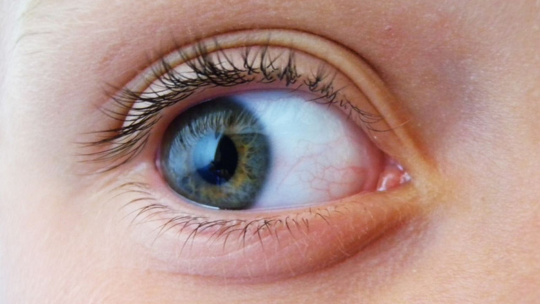 1619188612 eye 50346431280