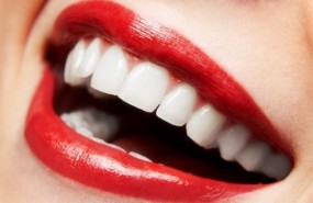 ep cosmetica dental dientes boca sonrisa