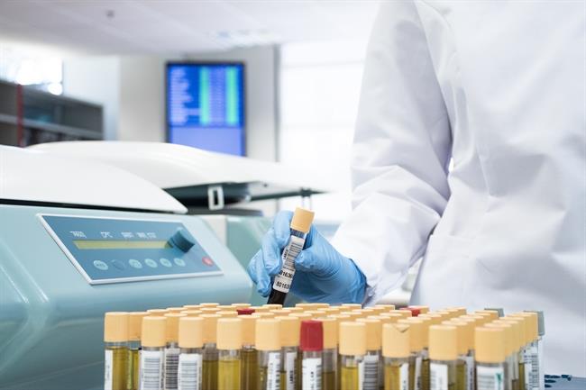 La Dgt Amplía El Número De Test De Control De Drogas, Que Realiza Synlab | EUROPA PRESS ep la dgt amplianumerotestcontroldrogas que realiza synlab