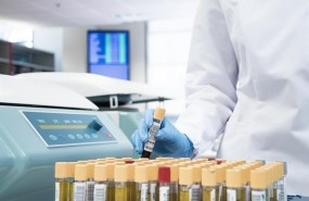 ep la dgt amplianumerotestcontroldrogas que realiza synlab