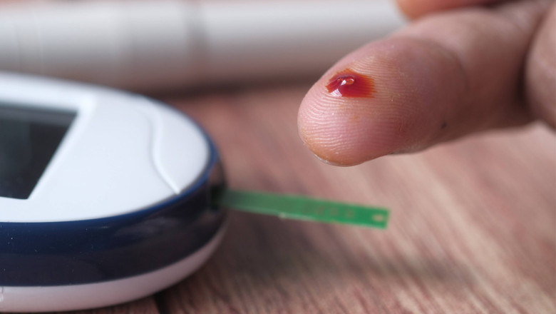 paciente anticoagulado 