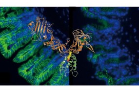 ep clostridium difficile
