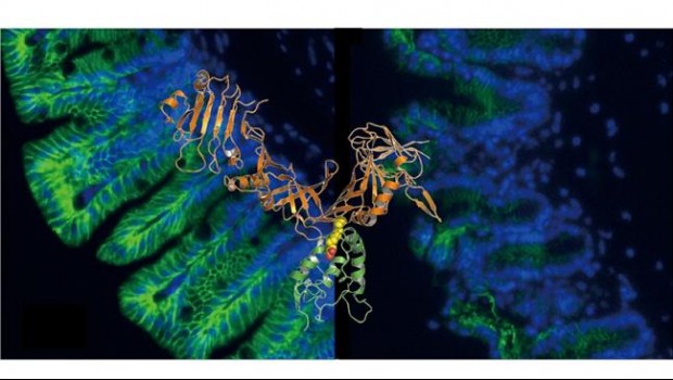 ep clostridium difficile